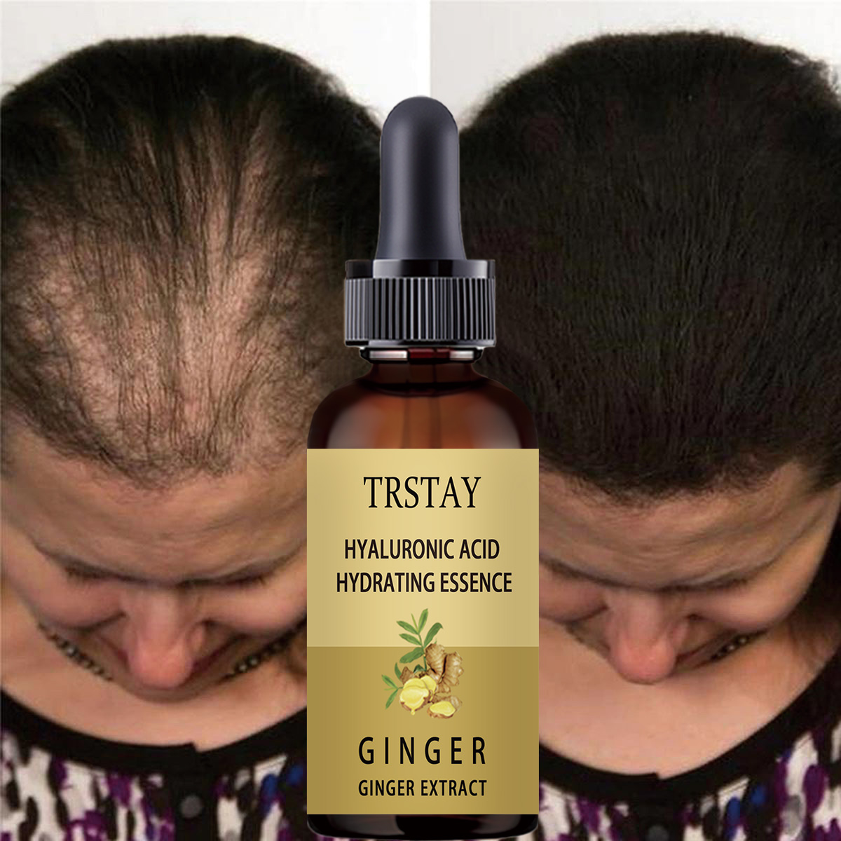 Hair Care Gisou - Suero para el crecimiento del cabello,