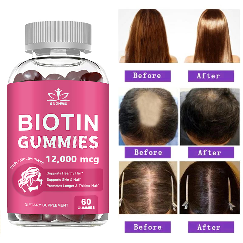 Hair Care Gummies - Gomitas de colágeno, gomas de biotina