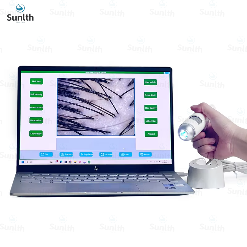 Sistema Windows con informe US - Hair Porosity Test reseña y precio