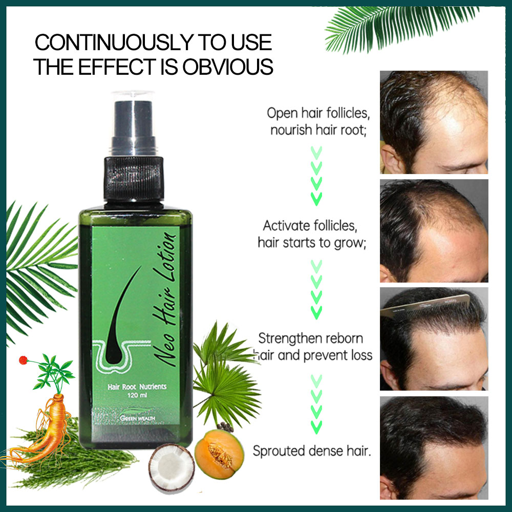 Loción para el cabello Neo Ori - Hair Care Gisou reseña y precio