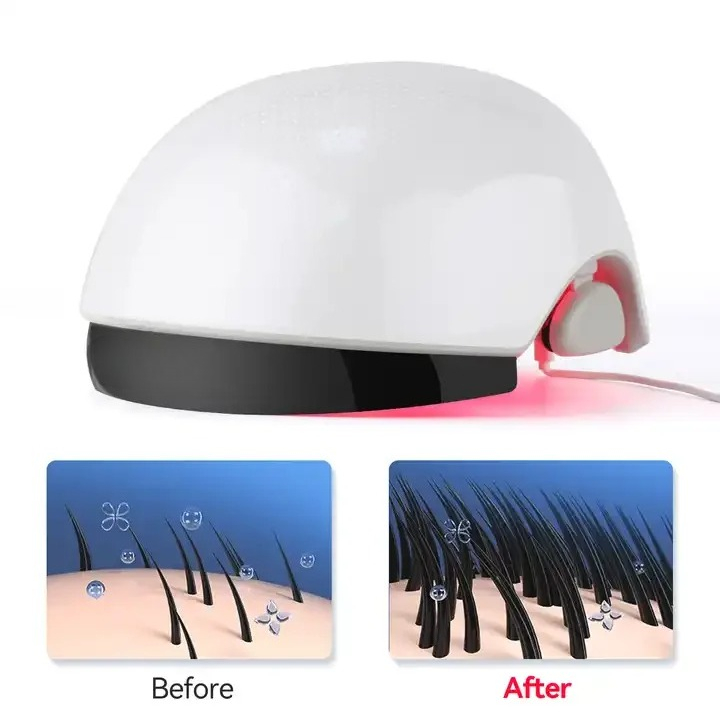 Casco de Fototerapia con Luz R - Hair Care Lab reseña y precio