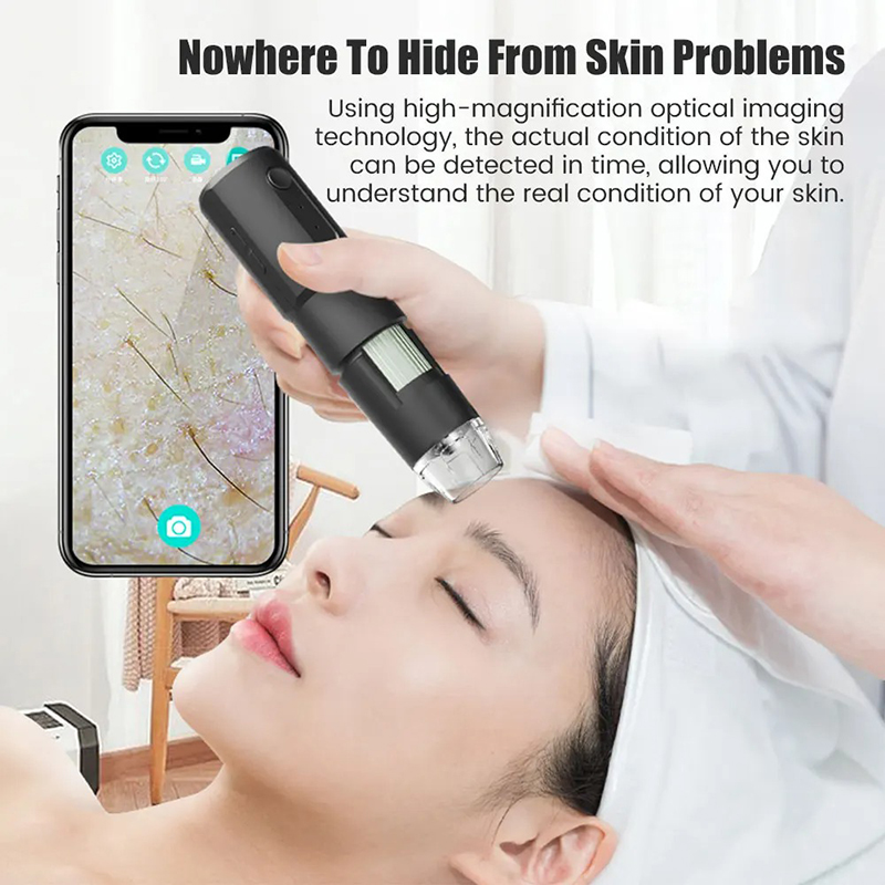 Dermatoscopio inalámbrico, máq - Hair Porosity Test reseña y precio